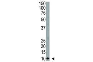 Western blot analysis of anti-Ubiquitin antibody and HeLa cell lysate