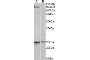 AP22405PU-N RBM20 antibody staining of Mouse Heart lysate at 1 µg/ml (35µg protein in RIPA buffer) with (B) and without (A) blocking with the immunising peptide. (RBM20 anticorps  (AA 717-727))
