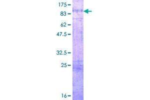 Image no. 1 for Poliovirus Receptor-Related 4 (PVRL4) (AA 1-510) protein (GST tag) (ABIN1316946)