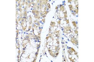 Immunohistochemistry of paraffin-embedded human stomach using TNFAIP6 antibody. (TNFAIP6 anticorps)
