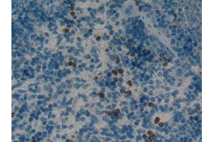 DAB staining on IHC-P; Samples: Rat Spleen Tissue
