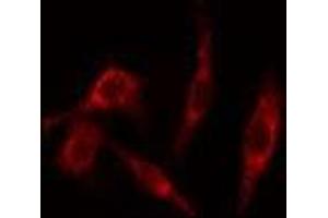 ABIN6277658 staining HeLa cells by IF/ICC. (TK1 anticorps  (N-Term))