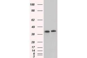 Image no. 13 for anti-Acetyl-CoA Acetyltransferase 2 (ACAT2) antibody (ABIN1496398)