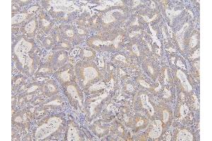 IHC analysis of RNF123 using anti-RNF123 antibody (ABIN6719387).