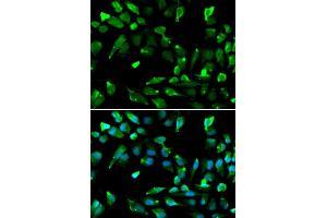 Immunofluorescence analysis of A549 cell using SATB1 antibody.
