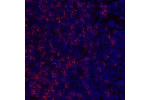 Immunofluorescence (IF) image for anti-CD8a Molecule (CD8A) (C-Term), (Cytoplasmic Domain) antibody (ABIN7449043) (CD8 alpha anticorps  (C-Term, Cytoplasmic Domain))