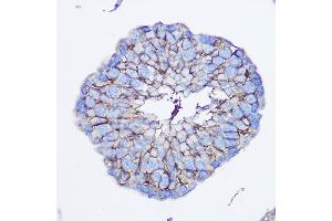 Immunohistochemistry of paraffin-embedded human colon using cGAS Rabbit pAb (ABIN6134073, ABIN6143590, ABIN6143591 and ABIN6224360) at dilution of 1:50 (40x lens).