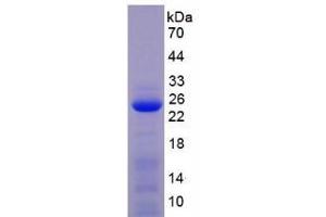 SDS-PAGE analysis of Mouse MMP1 Protein.