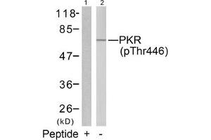 Western blot analysis of extracts from K562 cells using PKR(Phospho-Thr446) Antibody(Lane 2) and the same antibody preincubated with blocking peptide(Lane1). (EIF2AK2 anticorps  (pThr446))