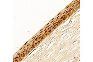 Immunohistochemistry of paraffin embedded rat eye using AQP0 (ABIN7074547) at dilution of 1: 200 (400x lens) (MIP anticorps)