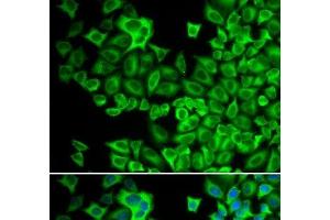 Immunofluorescence analysis of A549 cells using HCK Polyclonal Antibody (HCK anticorps)