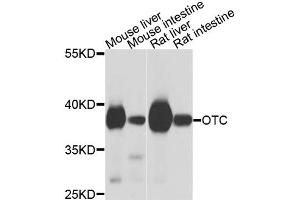 Western blot analysis of extracts of various cell lines, using OTC antibody. (OTC anticorps)