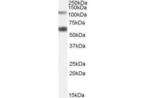 Western Blotting (WB) image for anti-Chromosome 19 Open Reading Frame 66 (C19ORF66) (N-Term) antibody (ABIN2791121) (C19ORF66 anticorps  (N-Term))