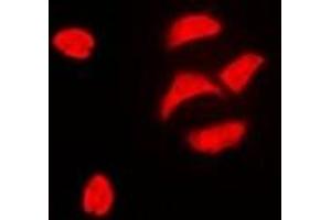 Immunofluorescent analysis of PBOV1 staining in HeLa cells. (PBOV1 anticorps)