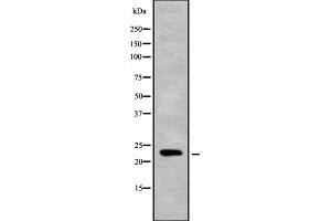 Western blot analysis of Mob3C using RAW264. (MOBKL2C anticorps  (Internal Region))