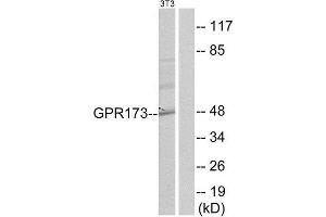 Western Blotting (WB) image for anti-G Protein-Coupled Receptor 173 (GPR173) (Internal Region) antibody (ABIN1852908) (GPR173 anticorps  (Internal Region))