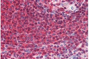 Human Spleen (formalin-fixed, paraffin-embedded) stained with GRB2 antibody ABIN364459 at 5 ug/ml followed by biotinylated anti-mouse IgG secondary antibody ABIN481714, alkaline phosphatase-streptavidin and chromogen.