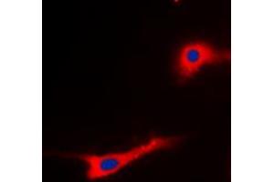 Immunofluorescent analysis of EEF2 (pT56) staining in SKOV3 cells.