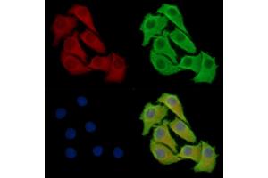 anti-beta-1,3-N-Acetylglucosaminyltransferase 4 (B3GNT4) antibody