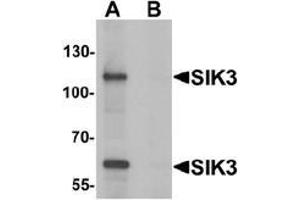 Western blot analysis of SIK3 in rat brain tissue lysate with SIK3 antibody at 1 ug/mL in (A) the absence and (B) the presence of blocking peptide. (SIK3 anticorps  (C-Term))