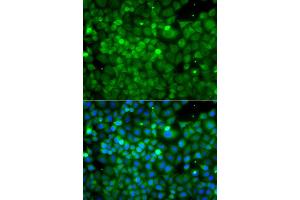 Immunofluorescence analysis of A549 cell using POC1A antibody. (POC1A anticorps)