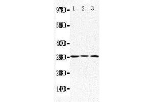 Anti-Apolipoprotein D antibody, Western blotting Lane 1: MCF-7 Cell Lysate Lane 2: HELA Cell Lysate Lane 3: SMMC Cell Lysate (Apolipoprotein D anticorps  (C-Term))