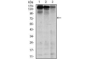 Western blot analysis using MSH6 mouse mAb against MCF-7 (1), HEK293 (2), and HCT116 (3) cell lysate.