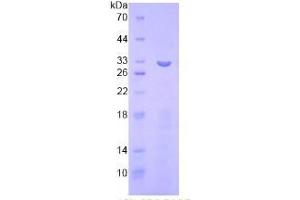 SDS-PAGE analysis of Human ITFG1 Protein. (ITFG1 Protéine)