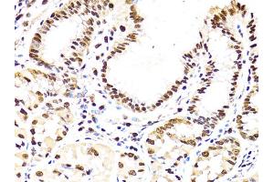 Immunohistochemistry of paraffin-embedded human stomach using PCNA antibody. (PCNA anticorps)