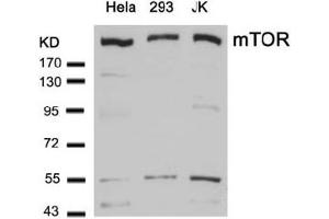 Image no. 1 for anti-Mechanistic Target of Rapamycin (serine/threonine Kinase) (mTOR) (Ser2448) antibody (ABIN319330) (MTOR anticorps  (Ser2448))