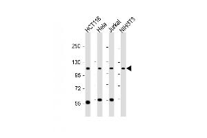 anti-PRP6 Pre-mRNA Processing Factor 6 Homolog (PRPF6) (AA 196-229), (N-Term) antibody
