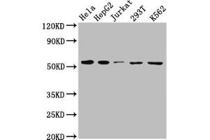 Western Blot Positive WB detected in: Hela whole cell lysate, HepG2 whole cell lysate, Jurkat whole cell lysate, 293T whole cell lysate, K562 whole cell lysate All lanes: MCT1 antibody at 1:1000 Secondary Goat polyclonal to rabbit IgG at 1/50000 dilution Predicted band size: 54, 47 kDa Observed band size: 54 kDa (Recombinant SLC16A1 anticorps)