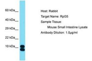 Image no. 1 for anti-Ribosomal Protein L35 (RPL35) (AA 61-110) antibody (ABIN6750520) (RPL35 anticorps  (AA 61-110))