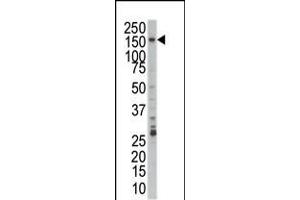 Western blot analysis of anti-PRP4 Pab in Jurkat cell lysate (PRPF4B anticorps  (C-Term))