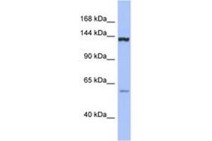 DHX34 抗体  (C-Term)