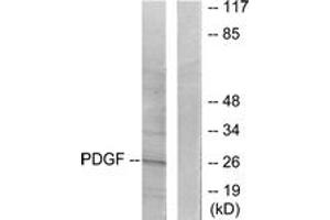 Western blot analysis of extracts from NIH-3T3 cells, using PDGFB Antibody. (PDGFB anticorps  (AA 16-65))