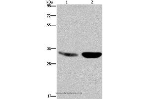 Western blot analysis of Human fetal brain and mouse brain tissue, using MAPRE3 Polyclonal Antibody at dilution of 1:500 (MAPRE3 anticorps)