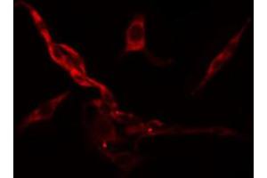 ABIN6274484 staining Hela cells by IF/ICC. (RPS6KC1 anticorps  (Internal Region))