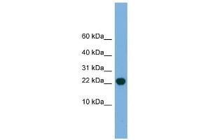 POP5 antibody used at 1 ug/ml to detect target protein. (POP5 anticorps)