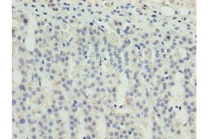 Immunohistochemistry of paraffin-embedded human adrenal gland tissue using ABIN7176155 at dilution of 1:100 (ZNF215 anticorps  (AA 12-304))