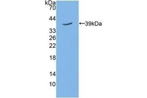 Detection of Recombinant TPBG, Mouse using Polyclonal Antibody to 5T4 (TPBG anticorps  (AA 34-356))