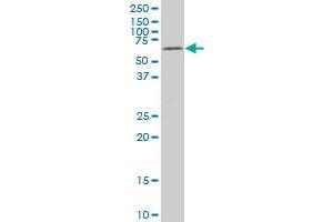 MAK monoclonal antibody (M01), clone 3E5 Western Blot analysis of MAK expression in HepG2 .
