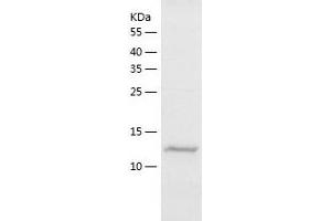 Western Blotting (WB) image for Selectin L (SELL) (AA 190-332) protein (His-IF2DI Tag) (ABIN7125012)
