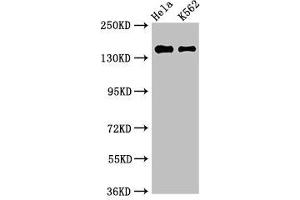 Western Blot Positive WB detected in: Hela whole cell lysate, K562 whole cell lysate All lanes: EEA1 antibody at 3 μg/mL Secondary Goat polyclonal to rabbit IgG at 1/50000 dilution Predicted band size: 163 kDa Observed band size: 163 kDa (EEA1 anticorps  (AA 734-875))