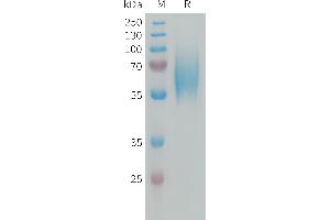 Human F Protein, His Tag on SDS-PAGE under reducing condition.