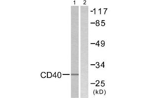Western Blotting (WB) image for anti-CD40 (CD40) (C-Term) antibody (ABIN1848816) (CD40 anticorps  (C-Term))