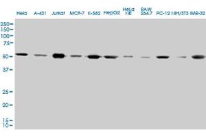 TUBA1 monoclonal antibody (M01), clone 2E11.