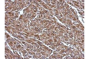 IHC-P Image Immunohistochemical analysis of paraffin-embedded U87 xenograft, using RABGGTB, antibody at 1:500 dilution.