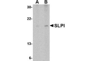 Image no. 1 for anti-Secretory Leukocyte Peptidase Inhibitor (SLPI) (Middle Region) antibody (ABIN318889) (SLPI anticorps  (Middle Region))