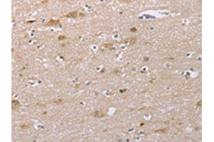 The image on the left is immunohistochemistry of paraffin-embedded Human brain tissue using ABIN7192262(SAMD9L Antibody) at dilution 1/30, on the right is treated with synthetic peptide. (SAMD9L anticorps)